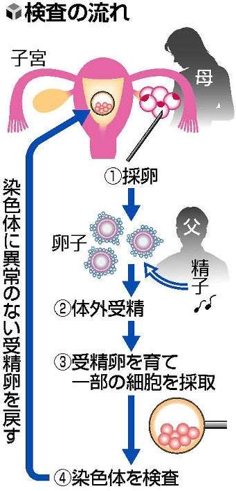 着床前検査「流産減らせる可能性あるが、出産率高まるかは検証必要」…日産婦が中間解析結果 : 医療・健康 : ニュース : 読売新聞オンライン
