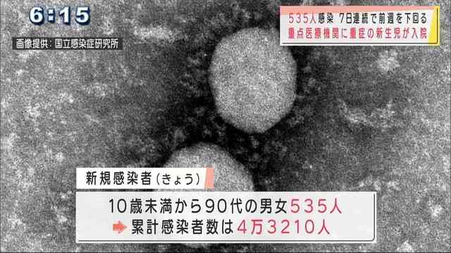 沖縄　新型コロナ新たに535人感染　新生児で重症も（沖縄ニュースQAB） - Yahoo!ニュース