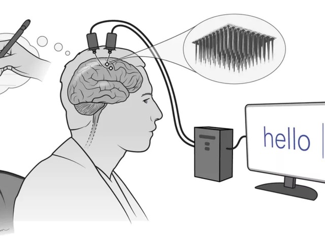 脳インプラントとAIを活用、思考で描いて文字入力する実験に成功--米大学 - CNET Japan