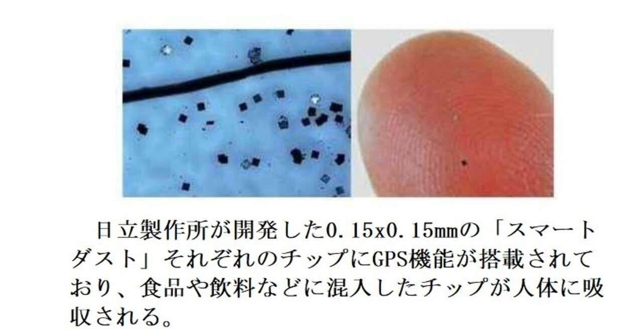 接種予約の電話5万5000回分つながらず…業者が転送設定ミス