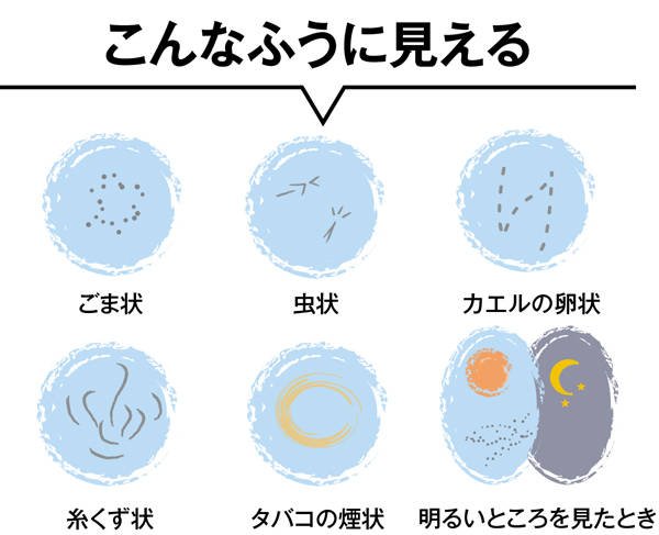 飛蚊症の人
