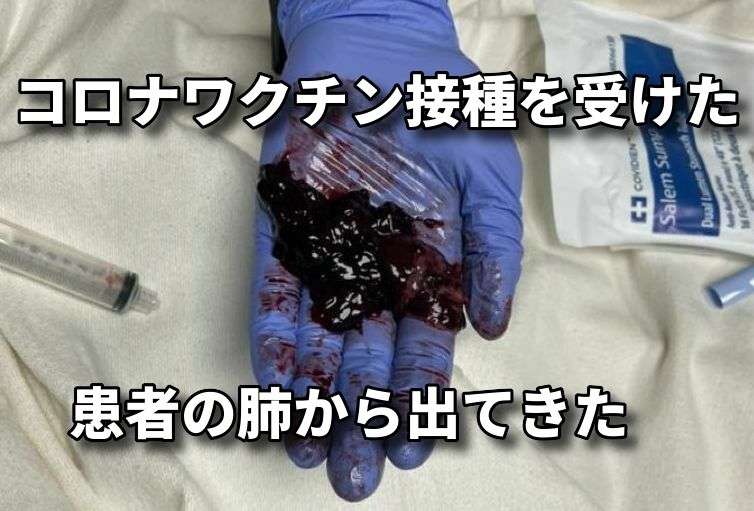 報告は氷山の一角！コロナワクチン接種後の副反応、死亡のツイートが多すぎて戦慄！vol.108 | 泣いて生まれてきたけれど