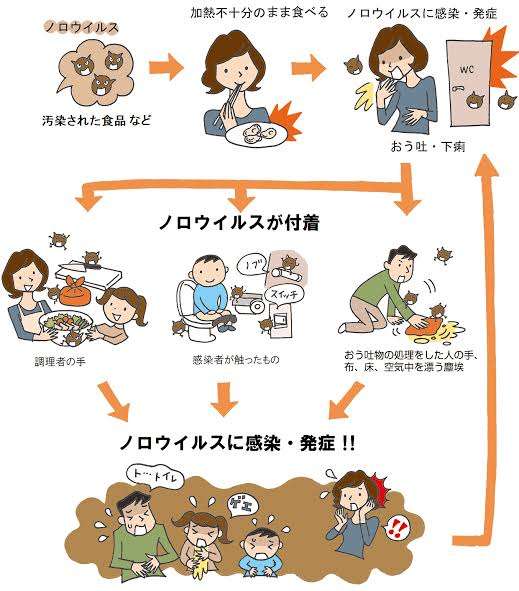 ノロウイルス（感染性胃腸炎・食中毒）体験談を語ろう ガールズちゃんねる Girls Channel