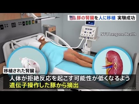 豚の腎臓を人に移植 実験成功 ＮＹ大学 - YouTube