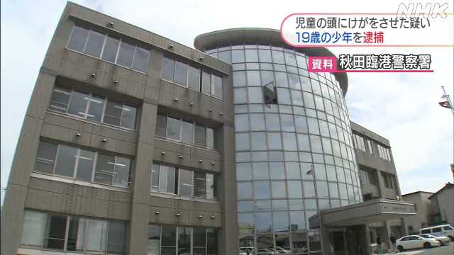 小学生を金属バットで殴った疑い １９歳の少年を逮捕 秋田市｜NHK 秋田県のニュース