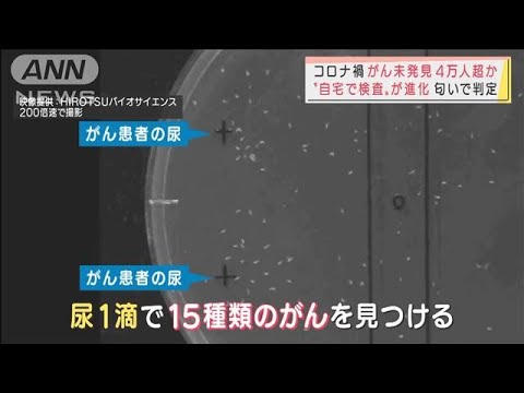 すい臓がん早期発見に光明　“自宅検査”も進化(2021年11月16日) - YouTube