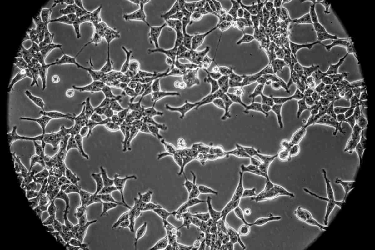 コロナワクチンの開発にヒトの胎児細胞が使われる理由（ナショナル ジオグラフィック日本版） - Yahoo!ニュース