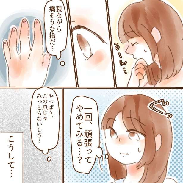 「シャンプーが地獄」やめたくてもやめられない、“爪を噛む癖”に苦しんだ漫画に共感続々「私も爪噛んじゃいます」