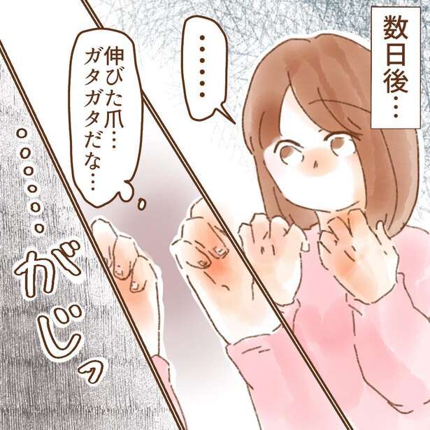 「シャンプーが地獄」やめたくてもやめられない、“爪を噛む癖”に苦しんだ漫画に共感続々「私も爪噛んじゃいます」