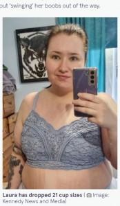 Pカップの胸に悩まされていた女性、寄付を募り縮小手術を受ける（英）