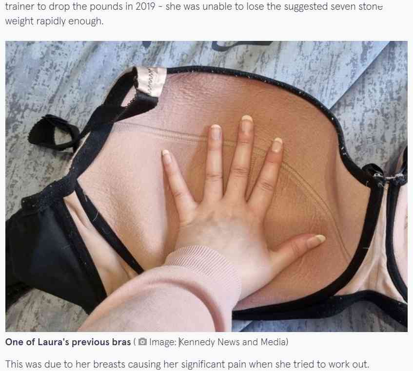 Pカップの胸に悩まされていた女性、寄付を募り縮小手術を受ける（英）