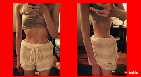 元モー娘。尾形春水も走った過激ダイエット 男性や子どもの患者も増加する「摂食障害」