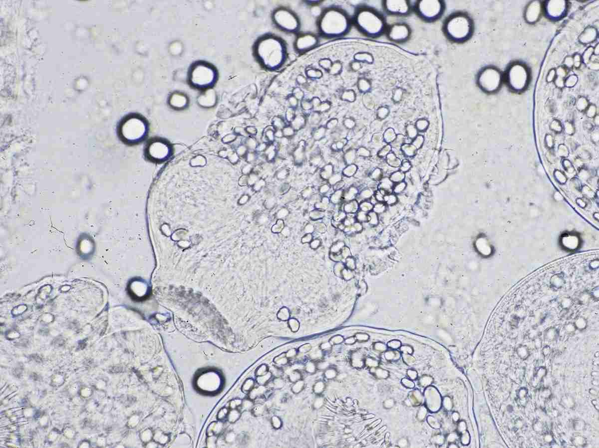 寄生虫「エキノコックス」、愛知県で犬の感染相次ぐ　人体に入ると重い肝機能障害 | 社会 | 全国のニュース | 福井新聞ONLINE