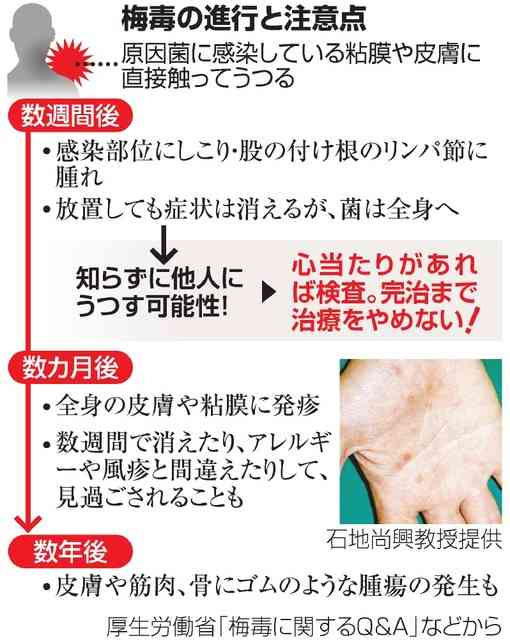 梅毒、患者に性風俗の利用歴を確認へ　増加受け国が対策：朝日新聞デジタル