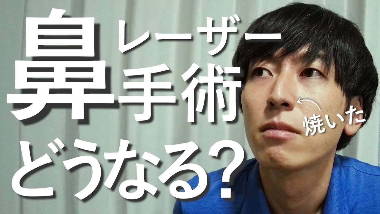 【花粉症・鼻炎】粘膜をレーザー手術で治療してみた！効果抜群すぎて最高！【効果・感想・費用】 - YouTube