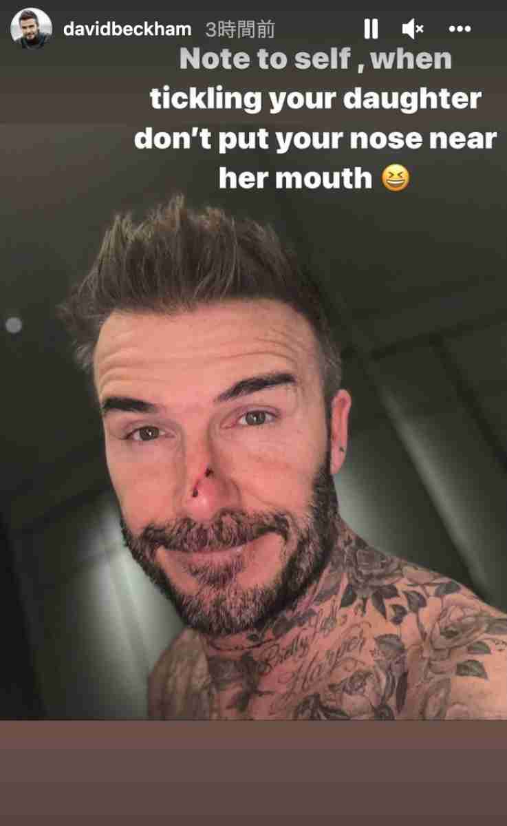 相変わらず愛娘にデレデレ！ デヴィッド・ベッカム、ちょっかいを出したハーパーから反撃を受け鼻から流血