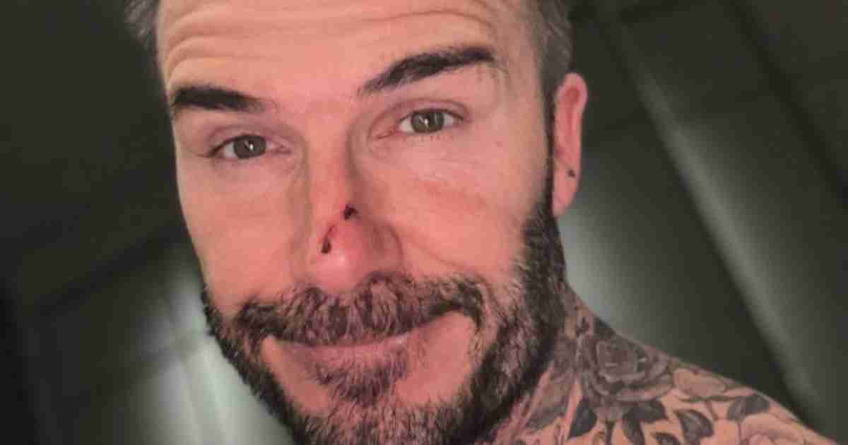 相変わらず愛娘にデレデレ！ デヴィッド・ベッカム、ちょっかいを出したハーパーから反撃を受け鼻から流血 - セレブニュース | SPUR