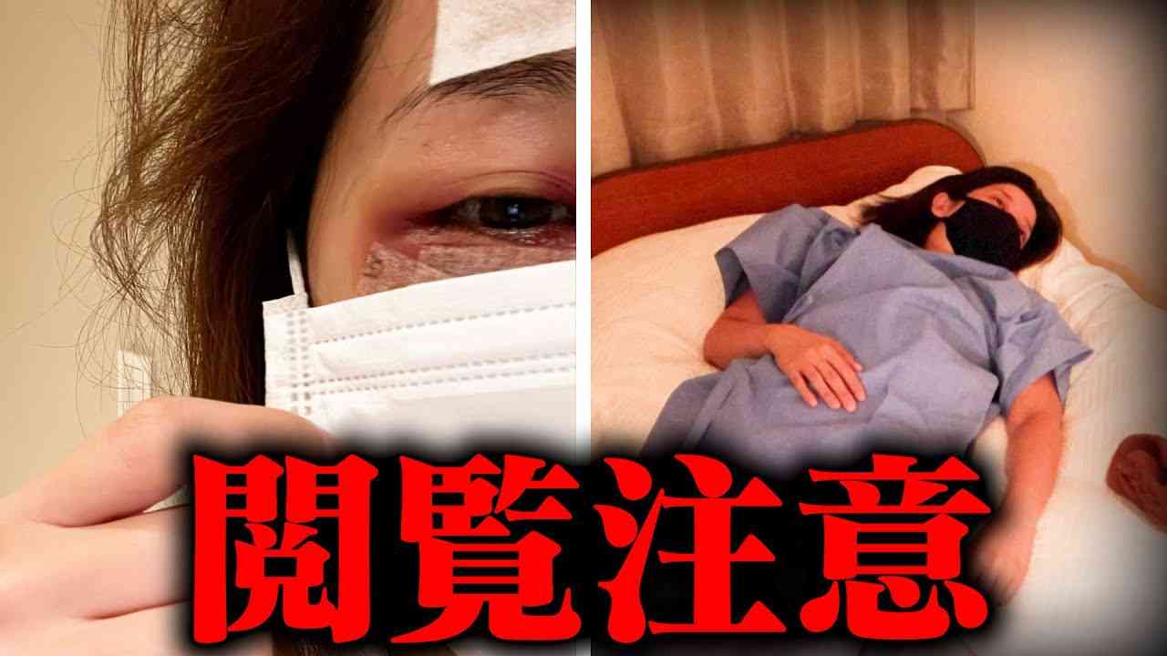 【整形密着】また整形したらダウンタイムえぐすぎた‪w - YouTube