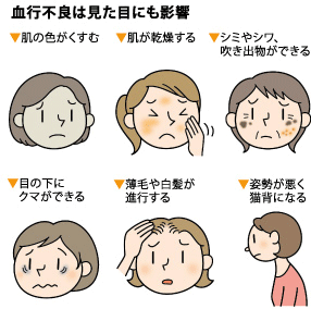 血行が悪い人あるある