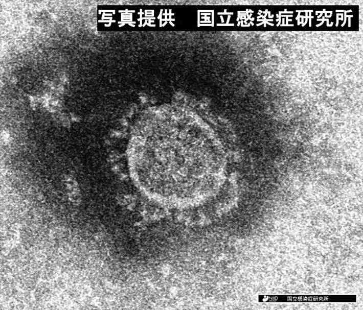 中外製薬、コロナ肺炎の治療薬を承認申請…関節リウマチ薬「アクテムラ」 : 医療・健康 : ニュース : 読売新聞オンライン
