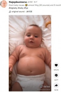 4歳児? 大人用おむつをつける体重16キロの1歳児「ロシア人の父の遺伝子」と母(豪)