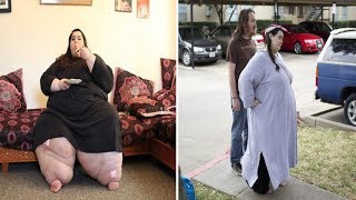体重300キロ超の男性、わずか1年9か月で約190キロの減量に成功（英）