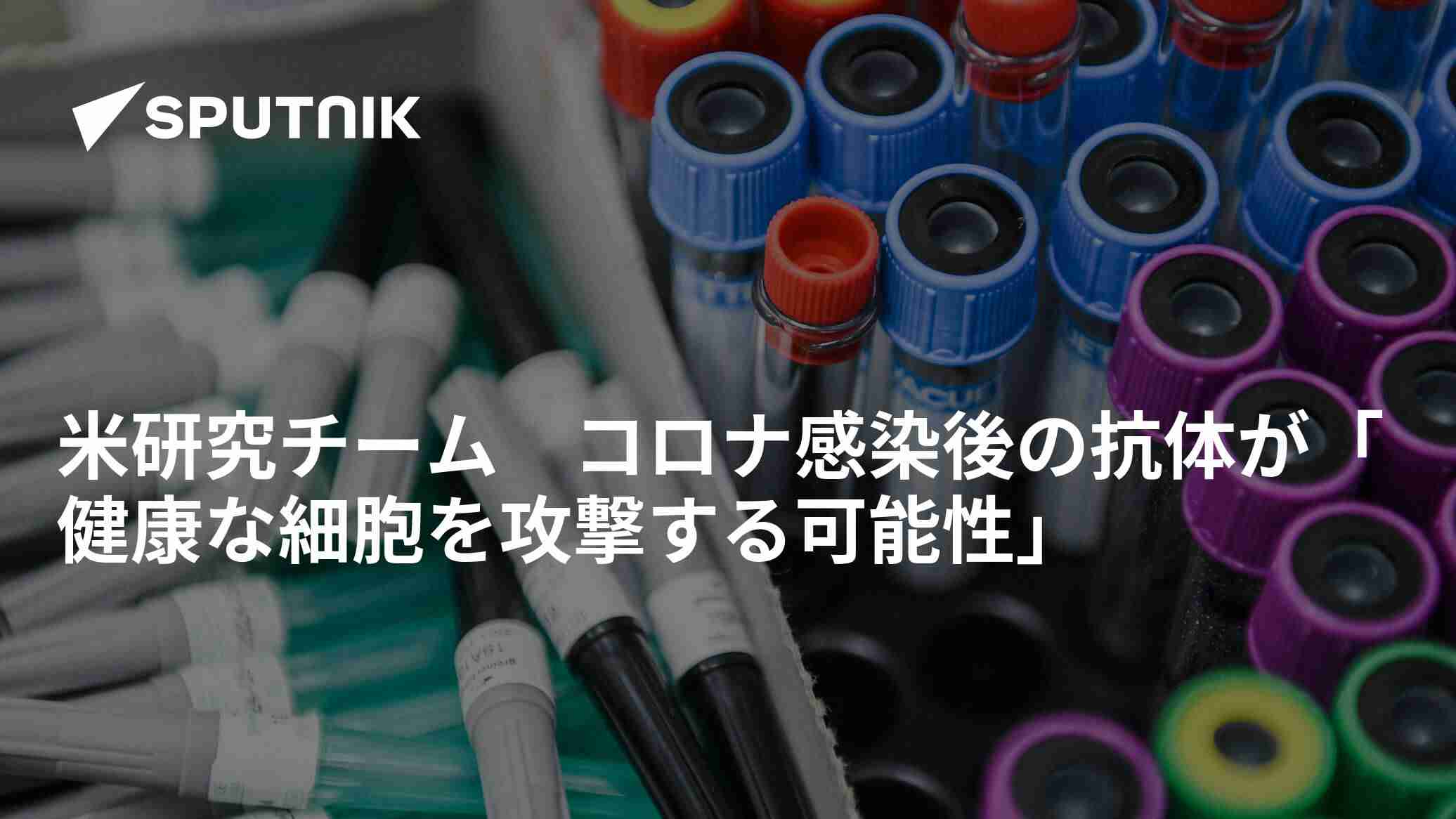 米研究チーム　コロナ感染後の抗体が「健康な細胞を攻撃する可能性」 - 2022年1月10日, Sputnik 日本