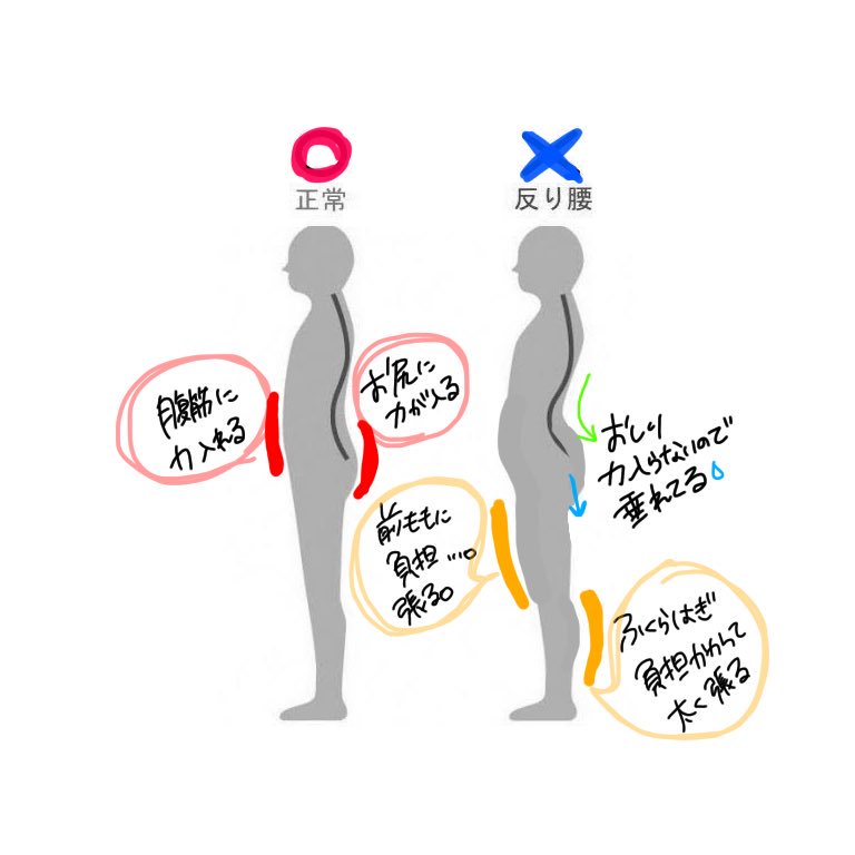 反り腰をどうにかしたい人！