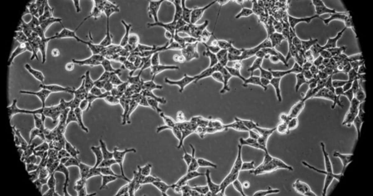 コロナワクチンの開発にヒトの胎児細胞が使われる理由: 日本経済新聞