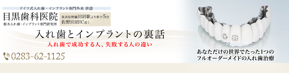 危険!保険の銀歯は海外では使用禁止です!-目黒歯科医院「入れ歯とインプラントの裏話」