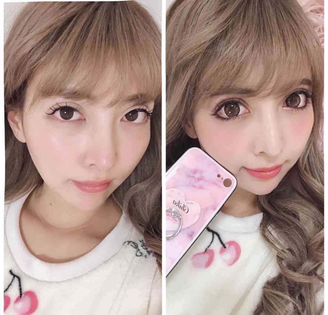 整形公表双子モデルの妹・吉川ちか、すっぴん＆メイク比較写真を公開　新たな整形願望も明かす