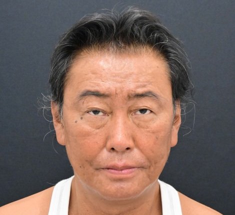 たいめいけん茂出木シェフ、総額300万円超の若返り整形 “内面から輝くためのパワーに”