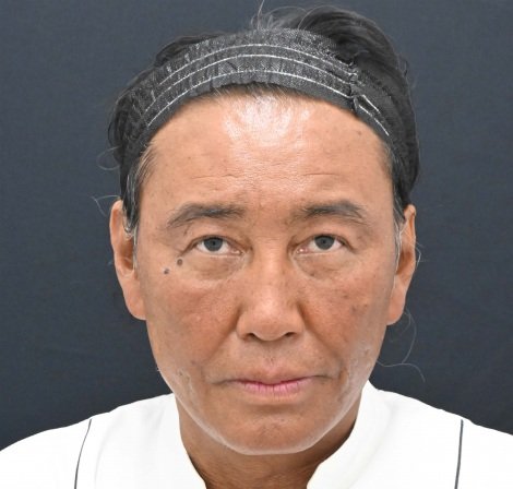 たいめいけん茂出木シェフ、総額300万円超の若返り整形 “内面から輝くためのパワーに”