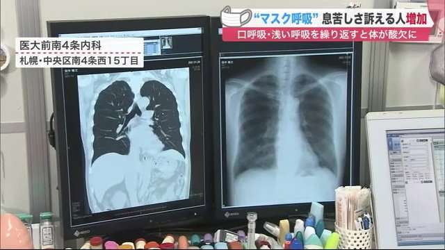 「マスク呼吸」で息苦しさ訴える人が増加…