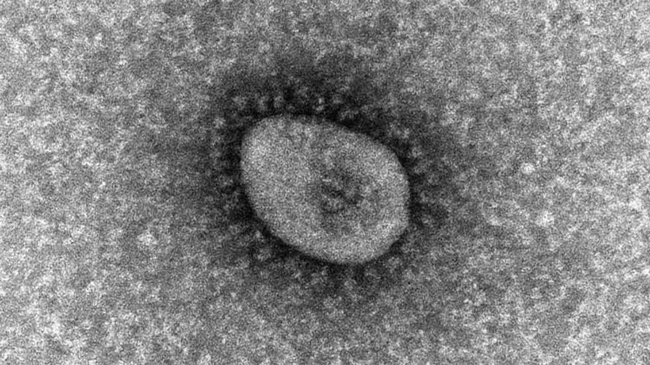 新変異株 基礎疾患ある2人死亡 - Yahoo!ニュース