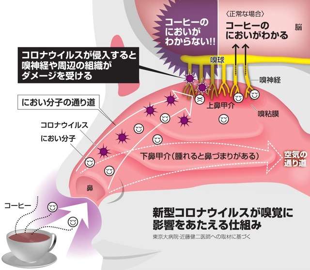新婚女性「カレーから下水のような異臭」…コロナ後遺症、半年たっても嗅覚は戻らず