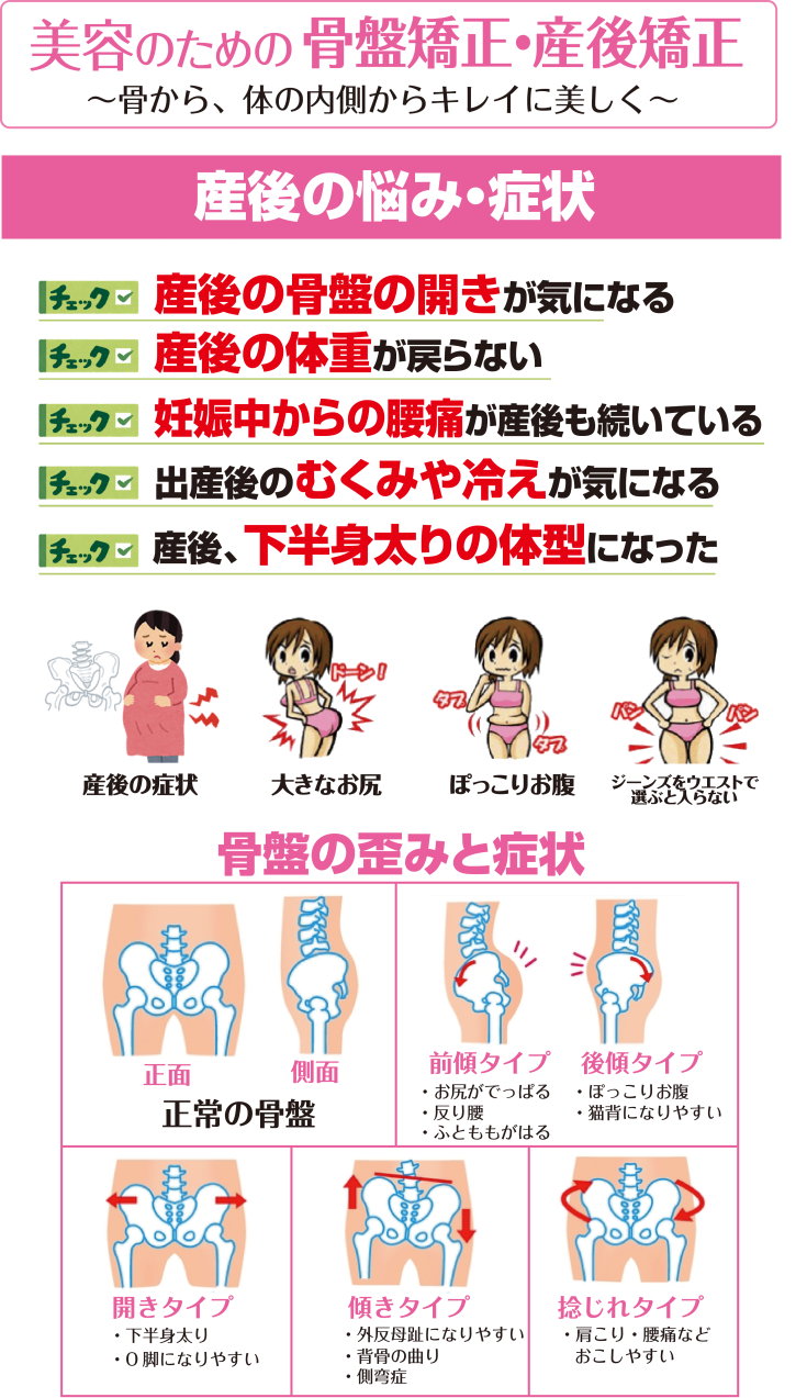 産後の骨盤矯正