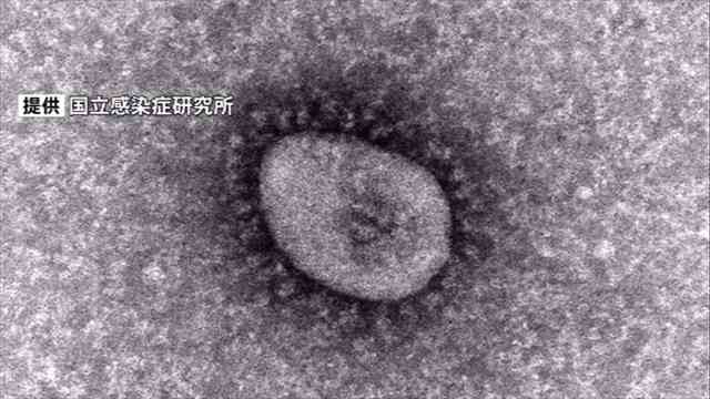 News Digest - オミクロン感染者は無症状・軽症でも10日間ほどウイルス排出し感染広げる可能性