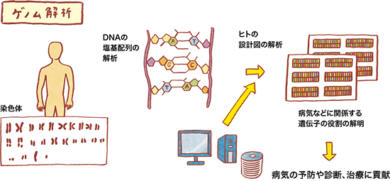 赤ちゃんの原因不明の病気 ゲノム解析で診断 慶応大など