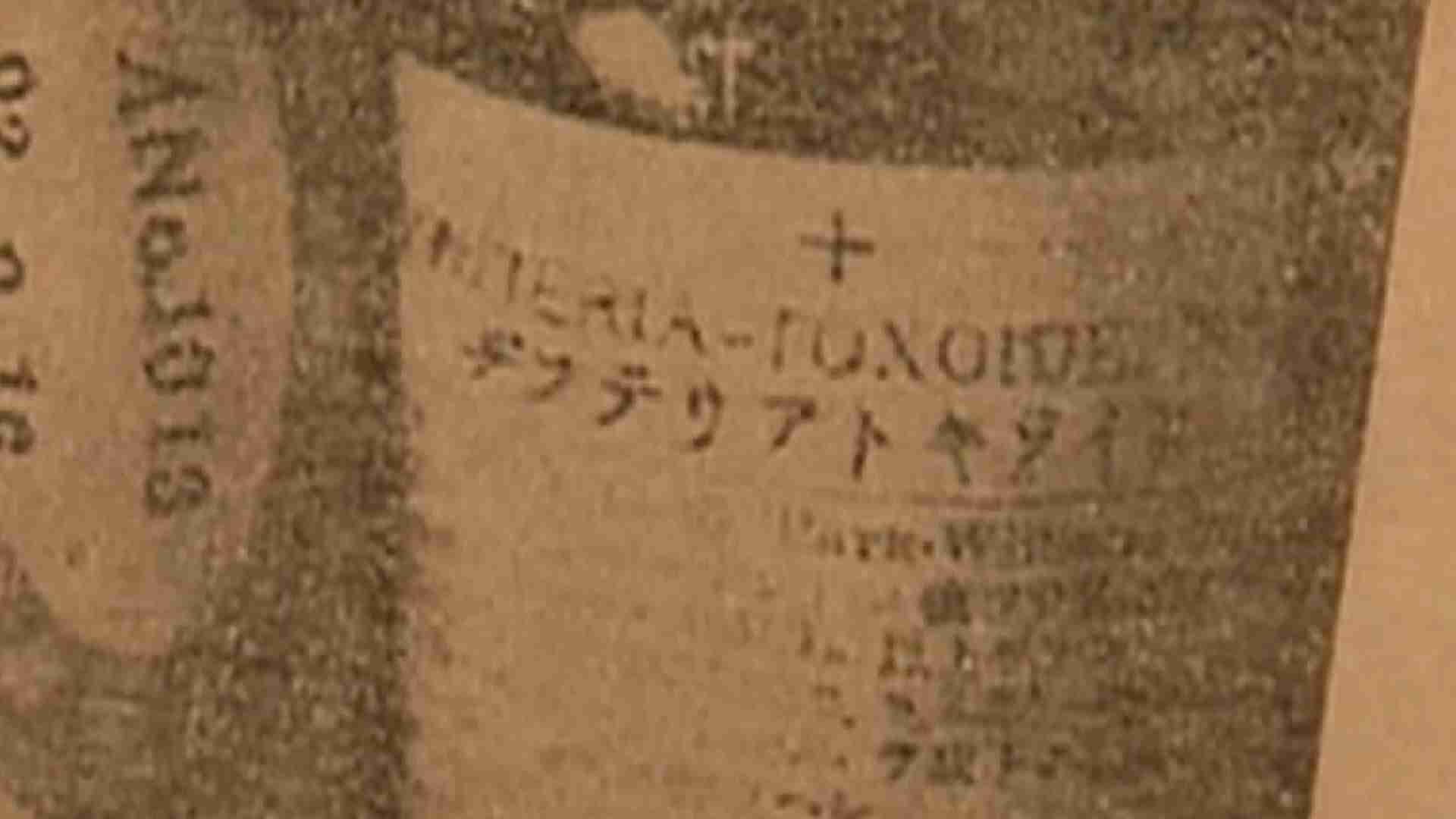 【特集】「ワクチン後進国」と呼ばれた日本...その背景には“過去最悪“と言われた『ジフテリア』など度重なる接種事故の歴史（MBSニュース） - Yahoo!ニュース