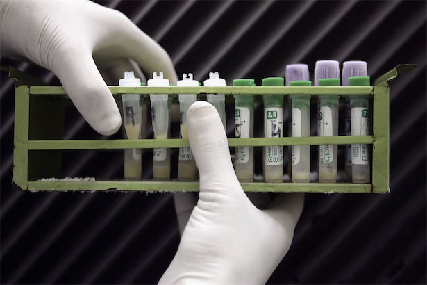 エイズ原因ウイルスHIV、発症を早める新たな変異株を確認（Forbes JAPAN） - Yahoo!ニュース