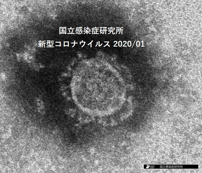 コロナの写真はウソでした① - prettyworldのブログ
