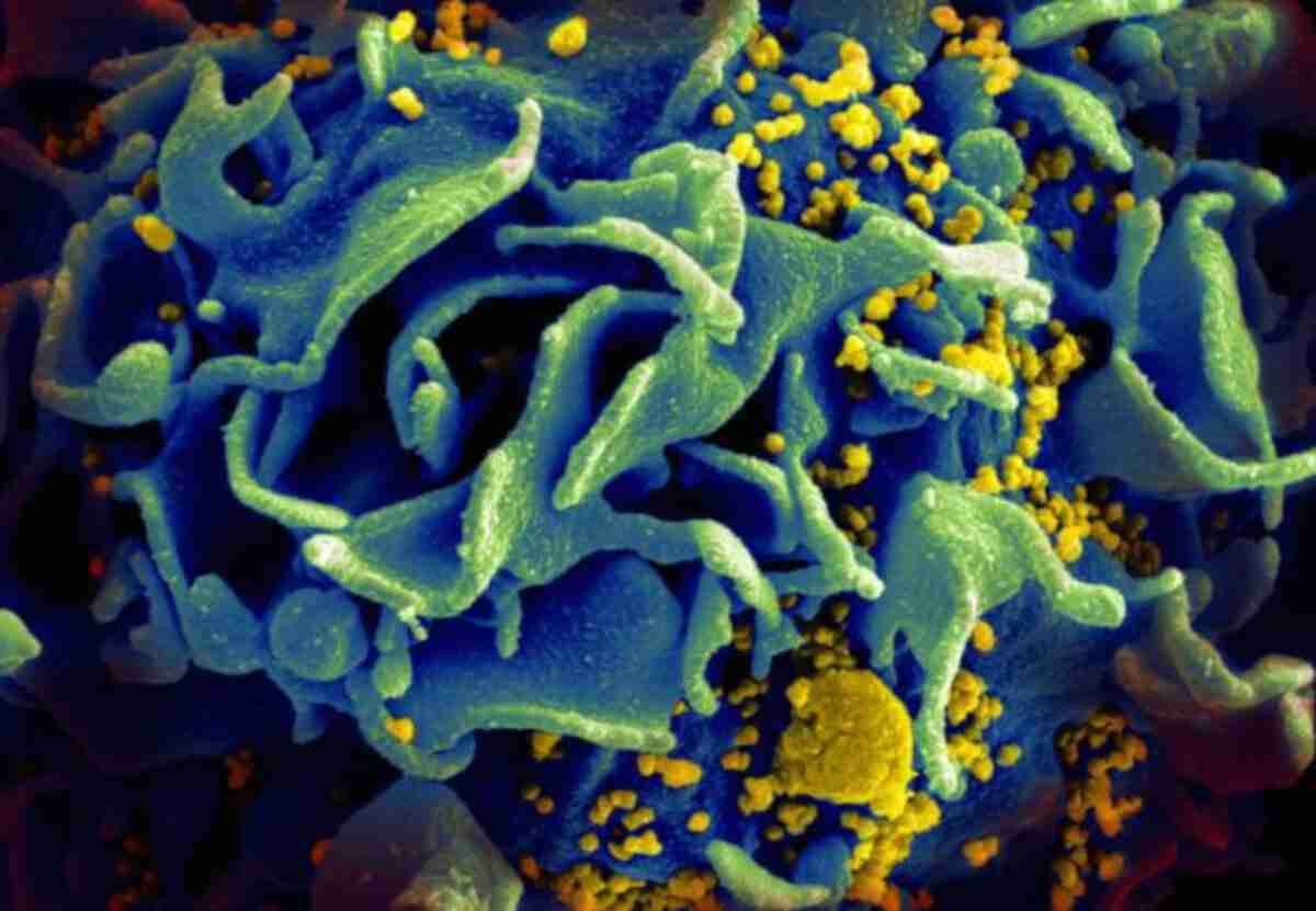 Discovery of new highly virulent and damaging HIV variant in the Netherlands