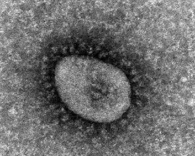 オミクロン株感染で入院の6割は2回接種済み 国立感染研の分析で判明（Science Portal） - Yahoo!ニュース