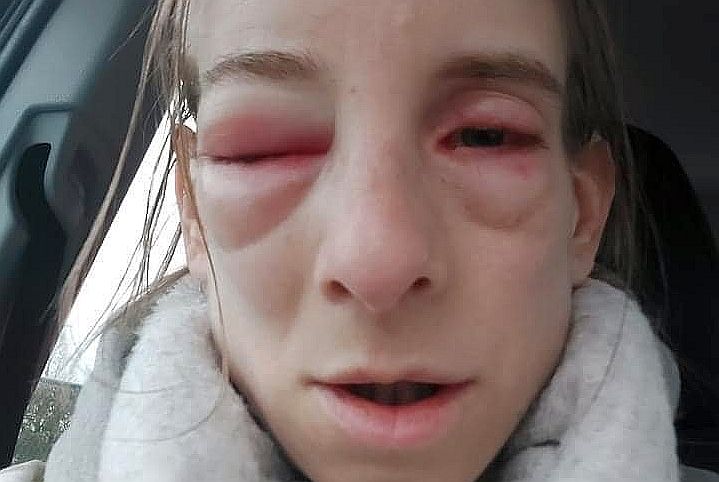 報告は氷山の一角！コロナワクチン接種後の副反応、死亡のツイートが多すぎて戦慄！vol.200 | 泣いて生まれてきたけれど