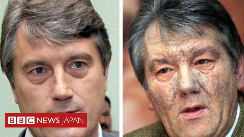 ロシアによる毒殺未遂　 元ウクライナ大統領の場合 - BBCニュース