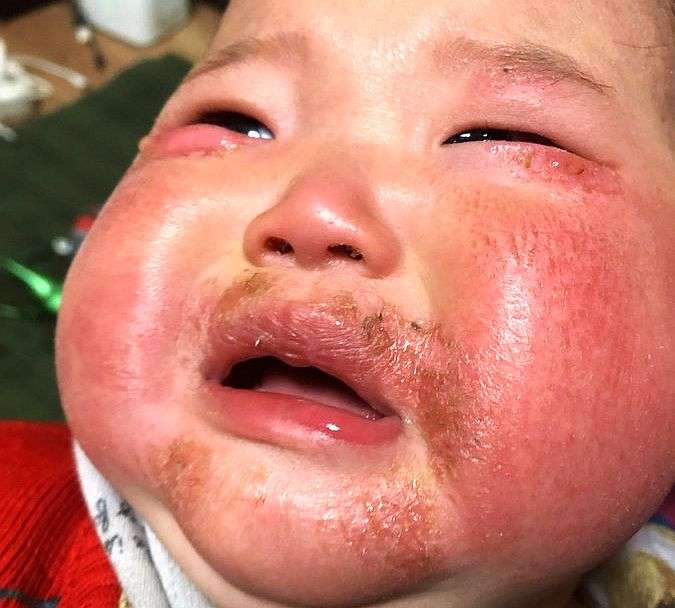 【コロナワクチン接種者は歩く生物兵器】毒の排出で非接種者が被害を受けているvol.4 | 泣いて生まれてきたけれど