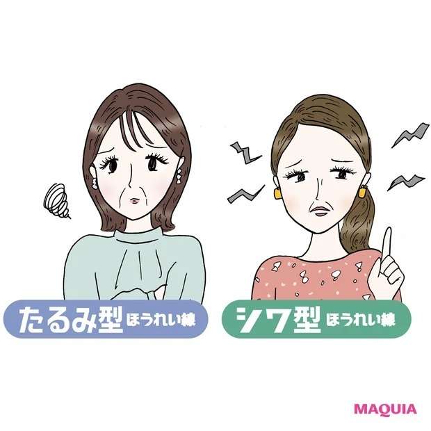 ほうれい線をどうにかしたい！ 座り方、寝方、食事で気をつけるポイントは？