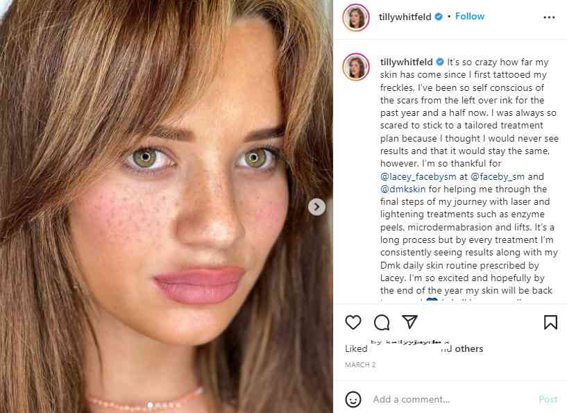 637bnexyl 9bbm 637bnexyl 9bbm