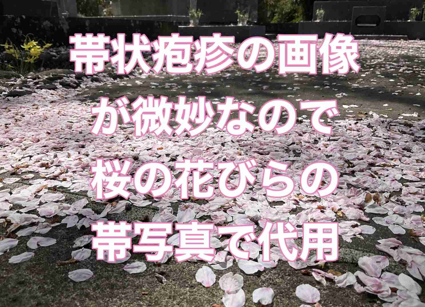 帯状疱疹の患者が急増中って騒ぎになってますが…